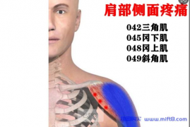 肩外侧疼痛评估与康复.mp4