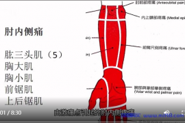 肘内侧疼痛.mp4