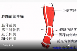 脚踝前侧疼痛康复.mp4