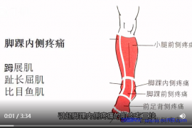 脚踝内侧疼痛康复.mp4