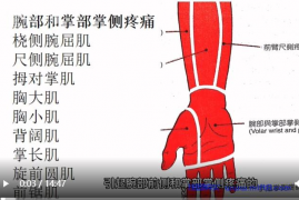 腕部和掌部掌侧疼痛.mp4