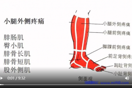 小腿外侧疼痛与康复.mp4