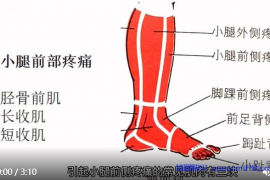 小腿前部疼痛与康复.mp4